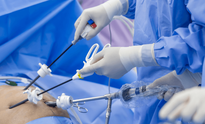Endoscopic Stone Surgery: PCNL, URS and Litholapaxy Explained