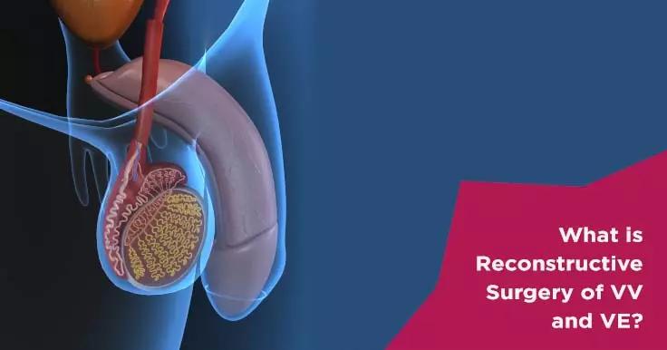 Reconstructive Urology: Vasectomy Reversal and VVF Repair