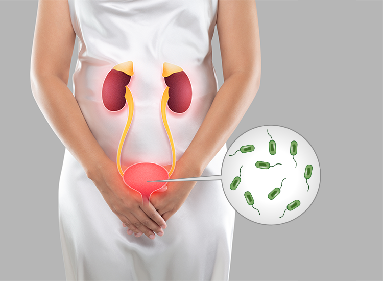 Urinary Problems